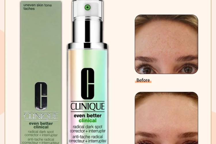Clinique Even Better Clinical Radical Dark Spot Corrector